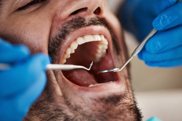 Best Dental Fillings (Composite and Amalgam)  in Bellville, OH
